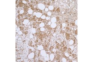 Immunohistochemistry (IHC) image for anti-Heat Shock 27kDa Protein 1 (HSPB1) (AA 155-205) antibody (ABIN7453920) (HSP27 抗体  (AA 155-205))