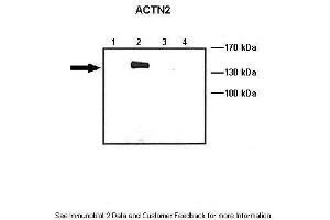 Lanes:   Lane1: 10 ug ACTN1-GFP transfected COS-7 lysate Lane2: 10 ug ACTN2-GFP transfected COS-7 lysate Lane3: 10 ug ACTN3-GFP transfected COS-7 lysate Lane4: 10 ug ACTN4-GFP transfected COS-7 lysate  Primary Antibody Dilution:   1: 1000  Secondary Antibody:   Anti-rabbit HRP  Secondary Antibody Dilution:   1:5000  Gene Name:   ACTN2  Submitted by:   Johannes W. (ACTN2 抗体  (C-Term))