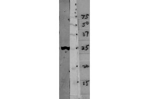 Blots of crude HeLa cell homogenate blotted with ABIN1580407 (left lane) and various molecular weight standards (right lane- numbers indicate apparent SDS-PAGE molecular weight in kDa).
