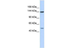 WB Suggested Anti-SF3B1 Antibody Titration:  0. (SF3B1 抗体  (N-Term))