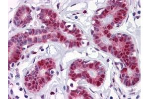 Immunohistochemistry (IHC) image for anti-TSC22 Domain Family, Member 3 (TSC22D3) (AA 1-98) antibody (ABIN614600) (TSC22D3 抗体  (AA 1-98))