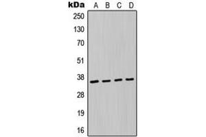 Western blot analysis of MAGEA6 expression in A549 (A), MCF7 (B), NIH3T3 (C), H9C2 (D) whole cell lysates. (MAGEA6 抗体  (Center))