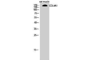 Western Blotting (WB) image for anti-Collagen, Type IV, alpha 1 (COL4A1) (N-Term) antibody (ABIN3184012)