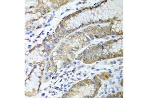 Immunohistochemistry of paraffin-embedded human stomach using ADH1C antibody at dilution of 1:100 (40x lens). (ADH1C 抗体)