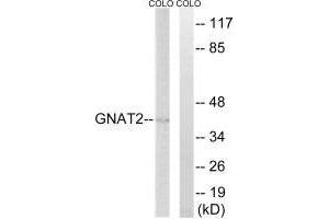 Western blot analysis of extracts from COLO cells, using GNAT2 antibody. (GNAT2 抗体)