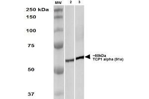 Western Blot analysis of Human A431 and HEK293 cell lysates showing detection of TCP1 alpha protein using Rat Anti-TCP1 alpha Monoclonal Antibody, Clone 91a . (TCP1 alpha/CCTA 抗体  (C-Term) (HRP))