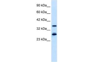 Western Blotting (WB) image for anti-Metal Response Element Binding Transcription Factor 2 (MTF2) antibody (ABIN2460909) (MTF2 抗体)