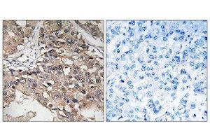 Immunohistochemistry (IHC) image for anti-Mitogen-Activated Protein Kinase Kinase Kinase 7 (MAP3K7) (Thr187) antibody (ABIN1848228) (MAP3K7 抗体  (Thr187))