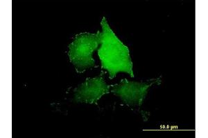 Immunofluorescence of purified MaxPab antibody to TNS4 on HeLa cell. (Tensin 4 抗体  (AA 1-480))