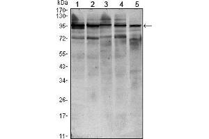 Western Blotting (WB) image for anti-Signal Transducer and Activator of Transcription 6, Interleukin-4 Induced (STAT6) antibody (ABIN969423)