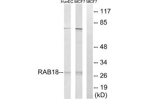 Western blot analysis of extracts from HuvEc cells and MCF-7 cells, using RAB18 antibody. (RAB18 抗体  (Internal Region))
