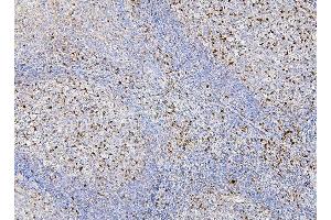 IHC analysis of RAB27A using anti-RAB27A antibody (ABIN7602714).