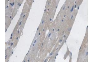 Immunohistochemistry (IHC) image for anti-Prenylcysteine Oxidase 1 (PCYOX1) (AA 249-505) antibody (ABIN7441472)