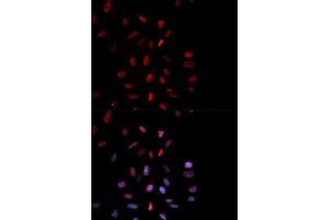 Immunofluorescence analysis of MCF-7 cells using Phospho-FOS-T232 antibody (ABIN5969895). (c-FOS 抗体  (pThr232))