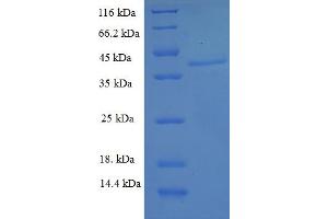 SDS-PAGE (SDS) image for Aspartate beta-Hydroxylase (ASPH) (AA 75-270) protein (His-SUMO Tag) (ABIN5709093)