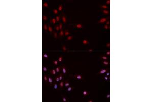 Immunofluorescence analysis of MCF-7 cells using Phospho-CHEK1-S317 antibody (ABIN5969879). (CHEK1 抗体  (pSer317))
