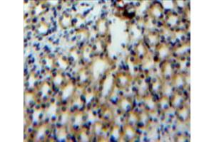 Used in DAB staining on fromalin fixed paraffin-embedded kidney tissue (S100A3 抗体  (AA 1-101))