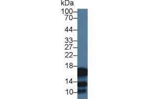 Western Blot; Sample: Human Saliva; Primary Ab: 3µg/ml Rabbit Anti-Human CST2 Antibody Second Ab: 0. (CST2 抗体  (AA 21-141))