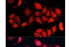 Immunofluorescence analysis of HeLa cells using CDK7 Polyclonal Antibody at dilution of 1:100 (40x lens). (CDK7 抗体)