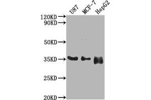 Western Blot Positive WB detected in: U87 whole cell lysate, MCF-7 whole cell lysate, HepG2 whole cell lysate All lanes: HMGCL antibody at 1:2000 Secondary Goat polyclonal to rabbit IgG at 1/50000 dilution Predicted band size: 35, 27, 21 kDa Observed band size: 35 kDa (HMGCL 抗体  (AA 28-325))