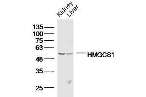 Lane 1: Mouse kidney lysates, Lane 2: Mouse liver lysates probed with HMGCS1 Polyclonal Antibody, Unconjugated  at 1:300 overnight at 4˚C. (HMGCS1 抗体  (AA 41-150))