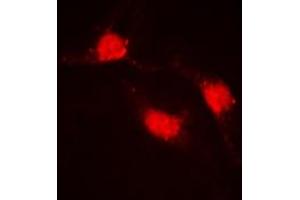 Immunofluorescent analysis of Beta-catenin staining in HeLa cells. (beta Catenin 抗体  (C-Term))