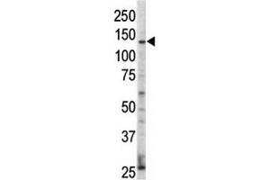 Western Blotting (WB) image for anti-V-Erb-A erythroblastic Leukemia Viral Oncogene Homolog 4 (Avian) (ERBB4) (AA 25-55) antibody (ABIN3029490)