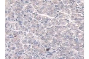 Immunohistochemistry (IHC) image for anti-Sulfatase 2 (SULF2) (AA 337-654) antibody (ABIN7441439)