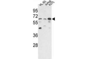 Western blot of hPPP3CC-E33 AP31353PU-N in HL-60, Jurkat, A375 cell line lysates (35 ug/lane). (PPP3CC 抗体  (N-Term))