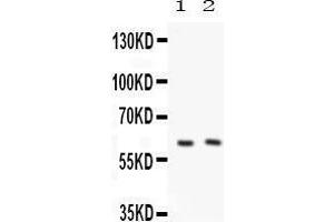 Anti-PKLR Picoband antibody, Western blotting All lanes: Anti PKLR  at 0. (PKLR 抗体  (C-Term))
