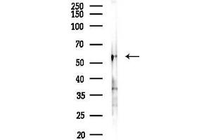 anti-Forkhead Box C1 (FOXC1) antibody