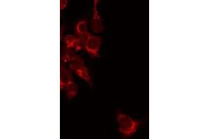 ABIN6277181 staining Hela by IF/ICC. (RAPGEF3 抗体  (C-Term))