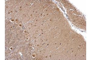 IHC-P Image O-GlcNAc transferase antibody detects O-GlcNAc transferase protein at cytoplasm and nucleus on rat hind brain by immunohistochemical analysis. (OGT 抗体)