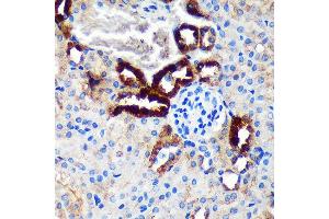 Immunohistochemistry of paraffin-embedded Mouse kidney using EML4 Rabbit pAb (ABIN7266891) at dilution of 1:100 (40x lens). (EML4 抗体  (AA 360-560))