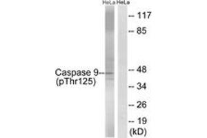 Western blot analysis of extracts from HeLa cells treated with TNF 20ng/ml 5'+calyculinA 50ng/ml 5', using Caspase 9 (Phospho-Thr125) Antibody. (Caspase 9 抗体  (pThr125))