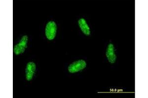 Image no. 2 for anti-Sin3A-Associated Protein, 30kDa (SAP30) (AA 131-220) antibody (ABIN599070) (SAP30 抗体  (AA 131-220))