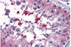 Human Testis: Formalin-Fixed, Paraffin-Embedded (FFPE) (ABCD4 抗体  (AA 136-149))