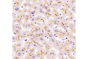 Immunohistochemistry of paraffin embedded human liver using Kiaa1324 (ABIN7073822) at dilution of 1:2500 (400x lens) (ELAPOR1 抗体)