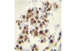 Formalin fixed, paraffin embedded human lung tissue stained with TBXAS1 Antibody  followed by peroxidase conjugation of the secondary antibody and DAB staining. (TBXAS1 抗体  (Middle Region))