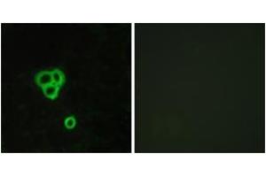 Immunofluorescence analysis of MCF7 cells, using GPR119 Antibody. (G Protein-Coupled Receptor 119 抗体  (AA 186-235))