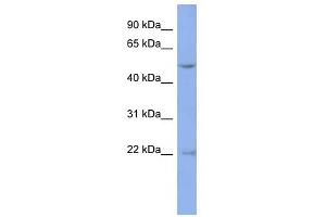 DAZ3 antibody used at 1 ug/ml to detect target protein. (DAZ3 抗体  (Middle Region))