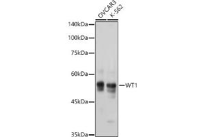 Western blot analysis of extracts of various cell lines, using WT1 antibody  at 1:1000 dilution. (WT1 抗体)