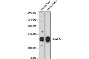 Western blot analysis of extracts of various cell lines, using CWC22 antibody. (CWC22 抗体)