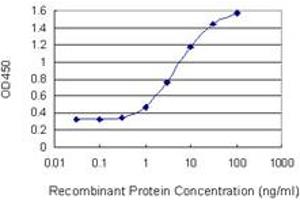 Detection limit for recombinant GST tagged GALK1 is 0. (GALK1 抗体  (AA 181-279))