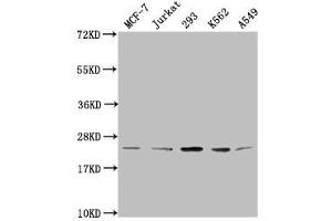 Western Blot Positive WB detected in: MCF-7 whole cell lysate, Jurkat whole cell lysate, 293 whole cell lysate, K562 whole cell lysate, A549 whole cell lysate All lanes: HIST1H1C antibody at 1:2000 Secondary Goat polyclonal to rabbit IgG at 1/40000 dilution Predicted band size: 22 kDa Observed band size: 22 kDa (HIST1H1C 抗体  (meLys96))
