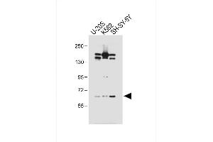 All lanes : Anti-LM3 Antibody (C-term) at 1:1000 dilution Lane 1: U-20S whole cell lysate Lane 2: K562 whole cell lysate Lane 3: SH-SY-5Y whole cell lysate Lysates/proteins at 20 μg per lane. (PALM3 抗体  (C-Term))