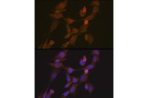 Immunofluorescence analysis of NIH-3T3 cells using STK33 Rabbit mAb (ABIN7270224) at dilution of 1:100 (40x lens). (STK33 抗体)