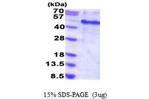 MAK16 Homolog (MAK16) (AA 1-300) protein (His tag)