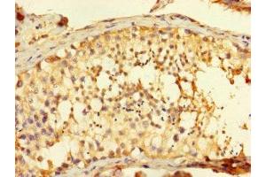 Immunohistochemistry of paraffin-embedded human testis tissue using ABIN7165534 at dilution of 1:100 (FAM71A 抗体  (AA 381-594))
