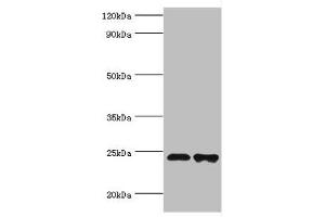 Western blot All lanes: Toll/interleukin-1 receptor domain-containing adapter protein antibody at 2 μg/mL Lane 1: K562 whole cell lysate Lane 2: Mouse kidney tissue Secondary Goat polyclonal to rabbit IgG at 1/10000 dilution Predicted band size: 24, 26, 28 kDa Observed band size: 24 kDa (TIRAP 抗体  (AA 1-221))